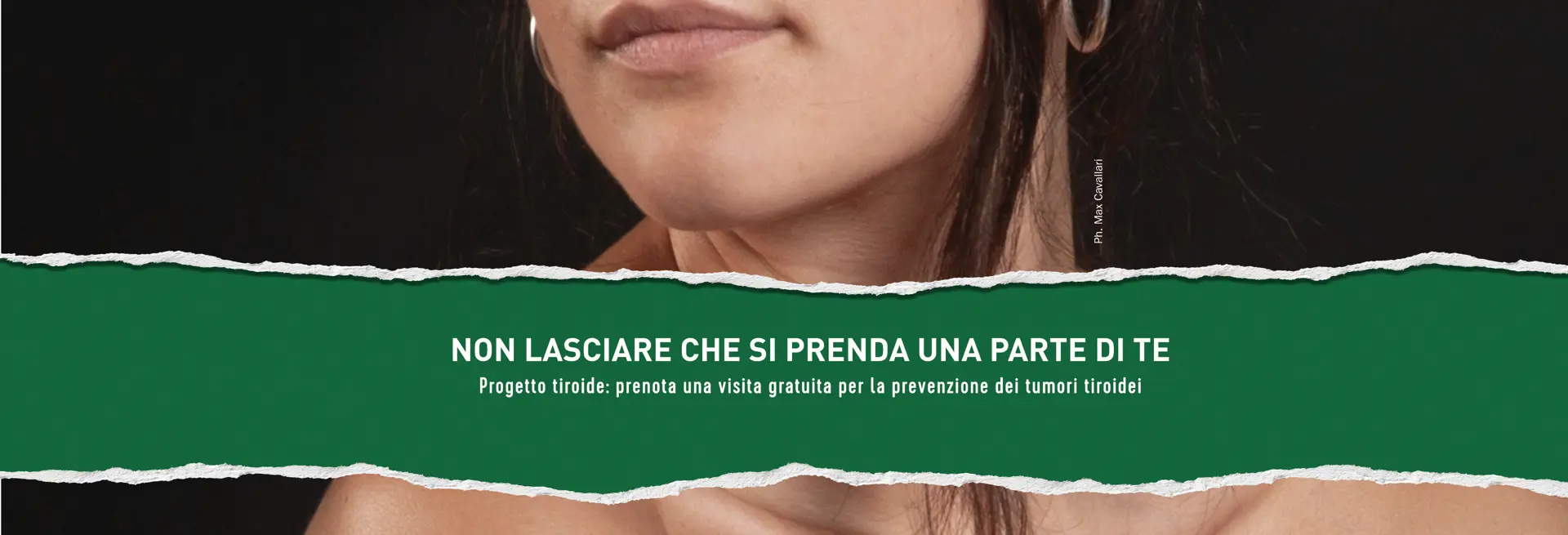 TIROIDE BANCA DI BOLOGNA Sito